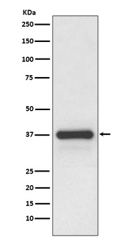 Podoplanin PDPN Rabbit Monoclonal Antibody