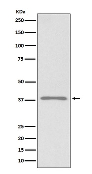 Podoplanin PDPN Rabbit Monoclonal Antibody