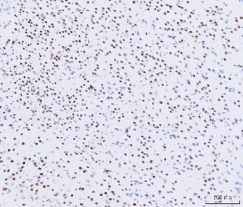 MEF2A+MEF2C/MEF2A Rabbit Monoclonal Antibody