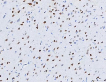MEF2A+MEF2C/MEF2A Rabbit Monoclonal Antibody