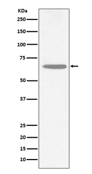 CHAT/Choline Acetyltransferase Rabbit Monoclonal Antibody