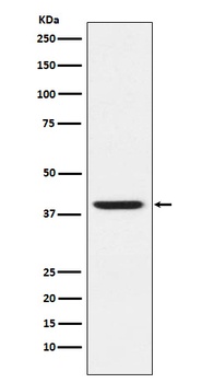 RING2 / RING1B / RNF2 Rabbit Monoclonal Antibody