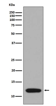 S100A4 Rabbit Monoclonal Antibody