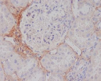TGFBI/Beta Ig H3 Rabbit Monoclonal Antibody