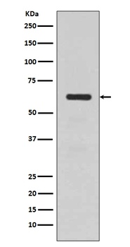 TGFBI/Beta Ig H3 Rabbit Monoclonal Antibody