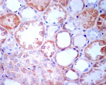 TGFBI/Beta Ig H3 Rabbit Monoclonal Antibody