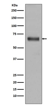 TGFBI/Beta Ig H3 Rabbit Monoclonal Antibody
