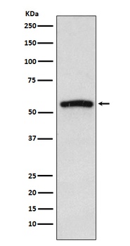 IRAK4 Rabbit Monoclonal Antibody