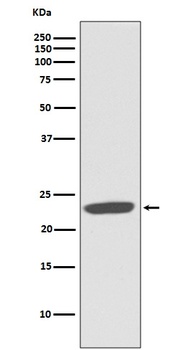 CD81 Rabbit Monoclonal Antibody