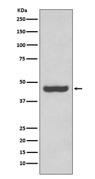 PAX2 Rabbit Monoclonal Antibody