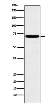 Heparanase 1 HPSE Rabbit Monoclonal Antibody