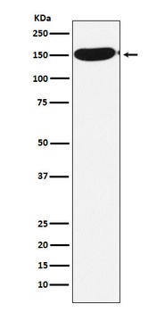 CPS1 Rabbit Monoclonal Antibody