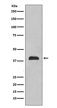 TTF1 NKX2-1/NKX2 Rabbit Monoclonal Antibody