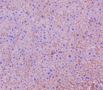 Cytokeratin 18 Krt18 Rabbit Monoclonal Antibody