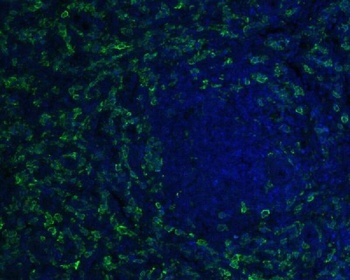 Iba1 AIF1 Rabbit Monoclonal Antibody