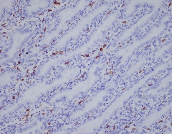IBA1 AIF1 Rabbit Monoclonal Antibody