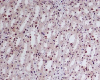 GATA2/3 Rabbit Monoclonal Antibody