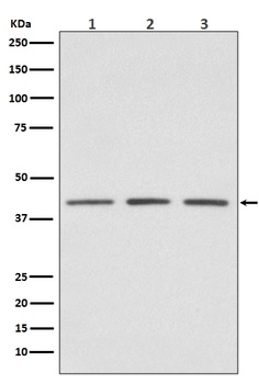 PRMT1 Rabbit Monoclonal Antibody