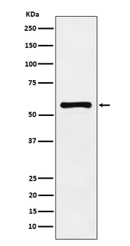 PAK2 Rabbit Monoclonal Antibody