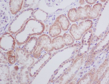BNIP3 Rabbit Monoclonal Antibody