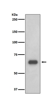 p70 S6 Kinase RPS6KB1 Rabbit Monoclonal Antibody