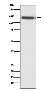 Ctip2 Rabbit Monoclonal Antibody