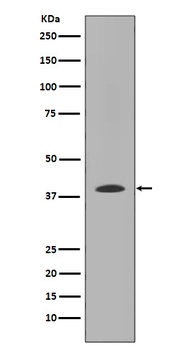 MMP12 Rabbit Monoclonal Antibody