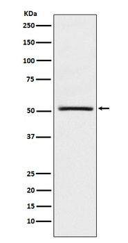 NR0B1/DAX1 Rabbit Monoclonal Antibody