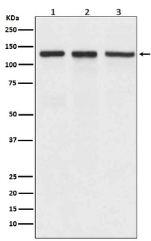 Integrin alpha V ITGAV Rabbit Monoclonal Antibody