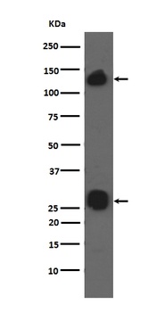Integrin alpha V ITGAV Rabbit Monoclonal Antibody