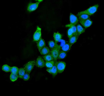 AIF/AIFM1 Mouse Monoclonal Antibody