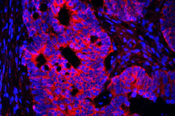 AIF/AIFM1 Mouse Monoclonal Antibody