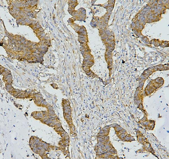 AIF/AIFM1 Mouse Monoclonal Antibody