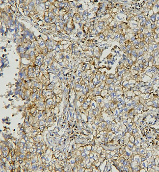 AIF/AIFM1 Mouse Monoclonal Antibody