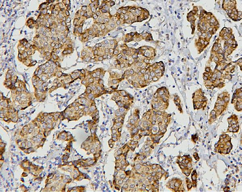 AIF/AIFM1 Mouse Monoclonal Antibody