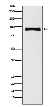 MALT1 Rabbit Monoclonal Antibody
