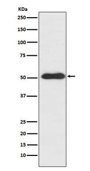 Slit2 Rabbit Monoclonal Antibody