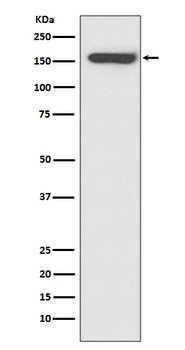 CD21 CR2 Rabbit Monoclonal Antibody
