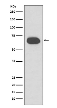 Cytokeratin 1 Rabbit Monoclonal Antibody