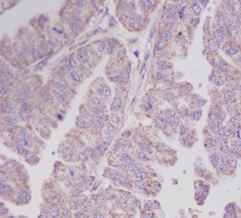 PEBP1/Pbp Rabbit Monoclonal Antibody