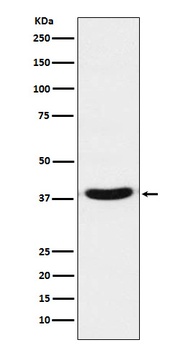 TRBP Rabbit Monoclonal Antibody