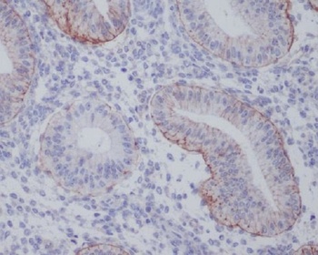 Integrin alpha 6 ITGA6 Rabbit Monoclonal Antibody