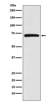 BIRC2 Rabbit Monoclonal Antibody