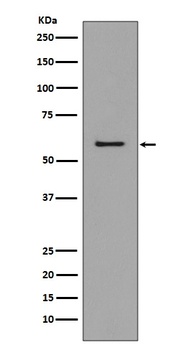 CCR3 Rabbit Monoclonal Antibody