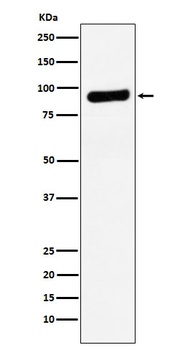 RRM1 Rabbit Monoclonal Antibody