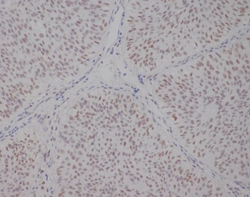 TFE3 Rabbit Monoclonal Antibody