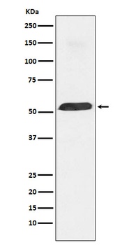 PTBP1 Rabbit Monoclonal Antibody