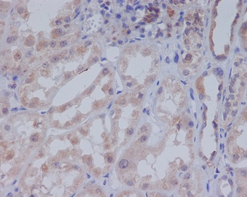 Acetyl-CoA Carboxylase Rabbit Monoclonal Antibody