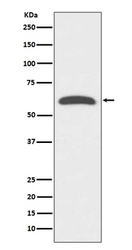 FoxO4/Afx Rabbit Monoclonal Antibody