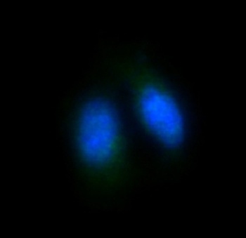 FoxO4/Afx Rabbit Monoclonal Antibody
